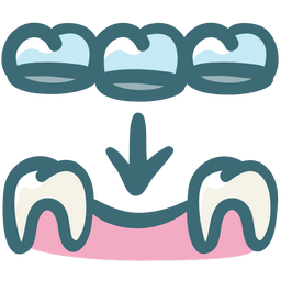Dentist Cartagena - Dr. Jairo Montoya DDS - Dental bridges